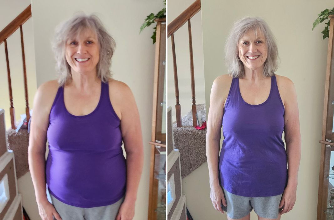 Before & After - Vyrna